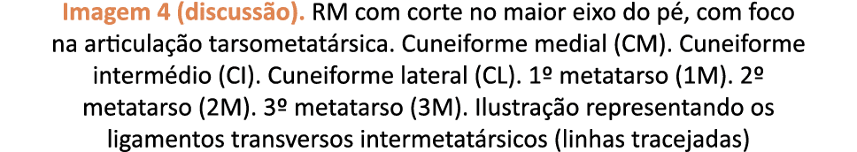 Imagem 4 (discuss o). RM com corte no maior eixo do p , com foco na articula o tarsometat rsica. Cuneiforme medial (...